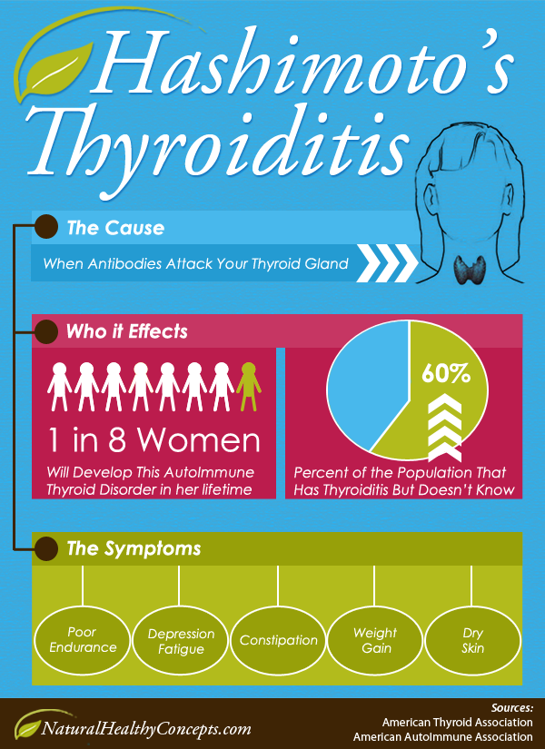 What are the Symptoms of Hashimoto’s Thyroiditis and are there Natural ...