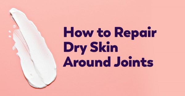 repair-skin-around-joints